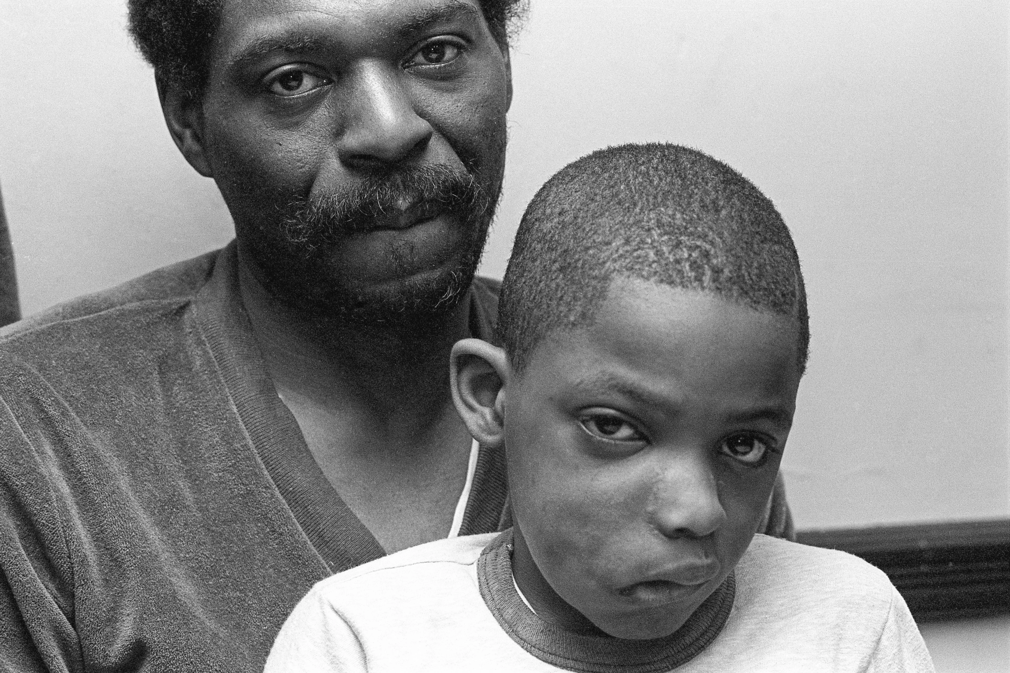 Ritratto in bianco e nero di un padre e suo figlio con il viso deformato.