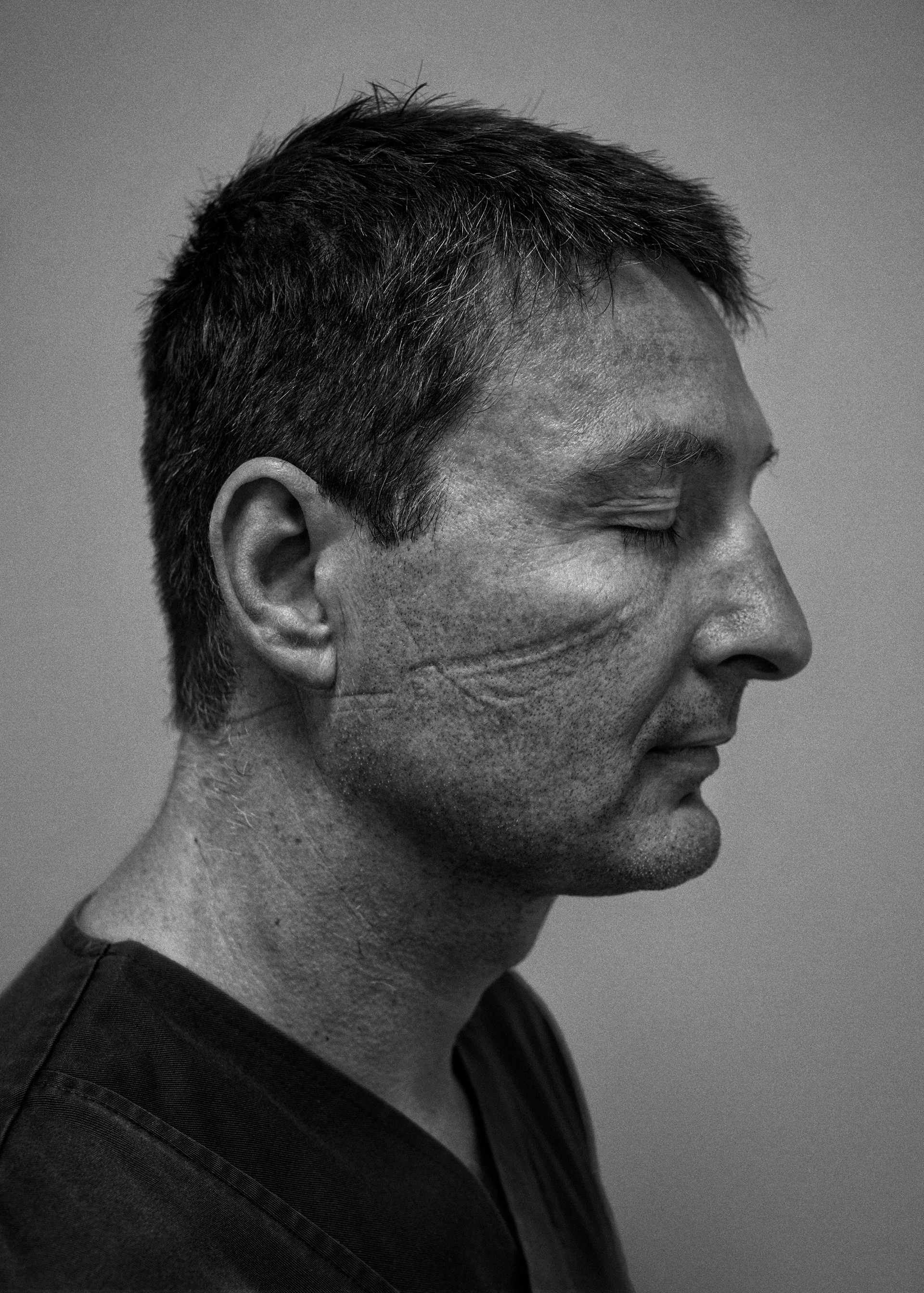 Black-and-white image: A man stands in profile with his eyes closed in front of a neutral background. His face looks exhausted and you can see deep imprints from a mask on it.